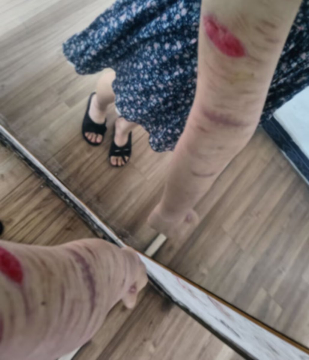 ovum0000's tweet photo. It’s fake, it’s special effects makeup. https://t.co/JJWHm1A07j