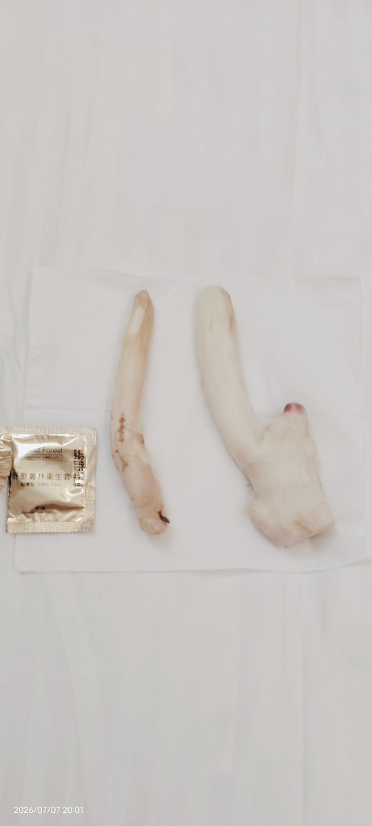 Fujiko__0713's tweet photo. 生病中……😷
照片為薑罰沒錯！這次是嫩薑，比較不刺痛，沒什麼感覺？😅 https://t.co/KHOE5XoKce