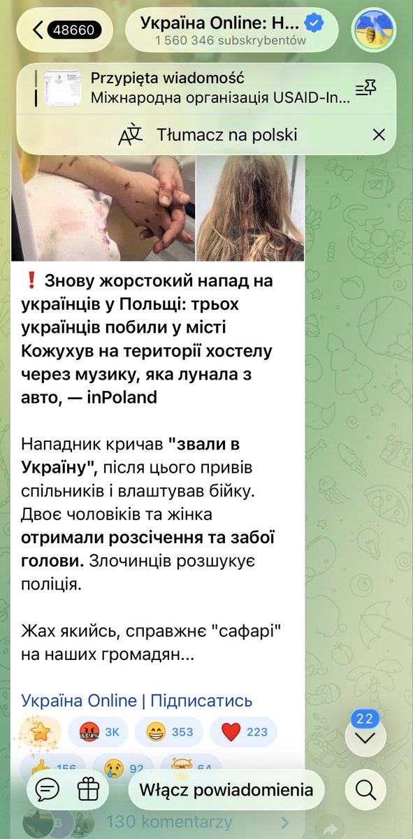 dwolosiuk's tweet photo. Ukraińskie media podsycają antypolskie nastroje. 

Na Ukrainie ani słowa o atakach Ukraińców na Polaków ale każde zdarzenie, w którym Ukraińcy zostali pokrzywdzeni jest skrupulatnie nagłośnione. 

To jest celowa systematycznie prowadzona akcja eskalacji konfliktu ukraińsko polskiego wywołana przez Kijów. 
O tej akcji mówił Budanow zapowiadając dalszą jej eskalację.