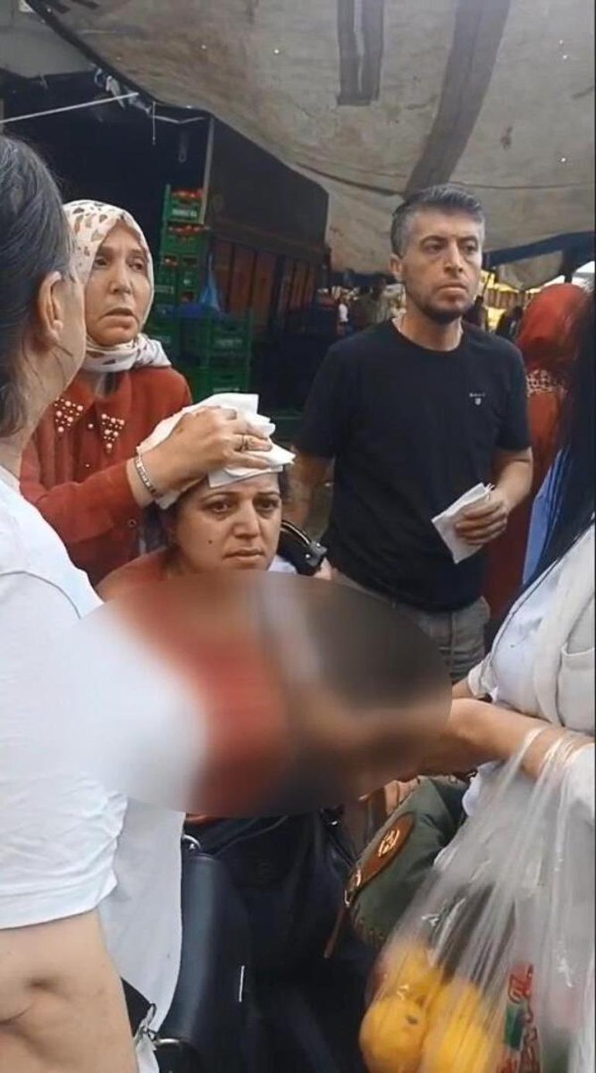 megahaberresmi's tweet photo. ARMUT SEÇME TARTIŞMASI KANLI BİTTİ: 
PAZARCI TUTUKLANDI

İstanbul Beyoğlu'ndaki bir semt pazarında, meyve seçme meselesi yüzünden çıkan tartışma şiddete dönüştü.

https://t.co/HI3WW2aTzQ https://t.co/yfVksCpM9l