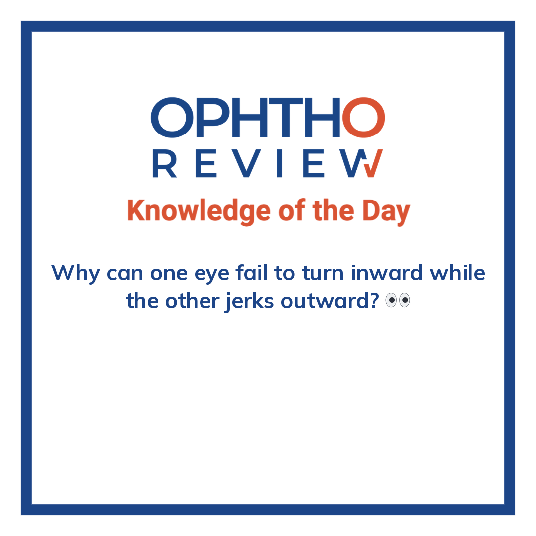 ophthoreview's tweet photo. One eye fail to turn inward

#ophthoreview #ophthalmology #ophtho #ophthalmologyresidency #ophthalmologist #surgicaleducation #medicaleducation #meded #surgery #medicalstudent #medicine #medicalschool #resident #residency https://t.co/rHqingbEkc