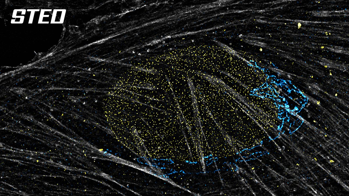 Abberior's tweet photo. Every imaging modality depends on one thing: a fluorophore you can rely on. Same sample, different techniques - STED, confocal, spinning disk, SIM - all with abberior STAR dyes. Designed for STED, reliable across modalities.
#STARdyes #STED #abberior https://t.co/zJ4nqq7ePY