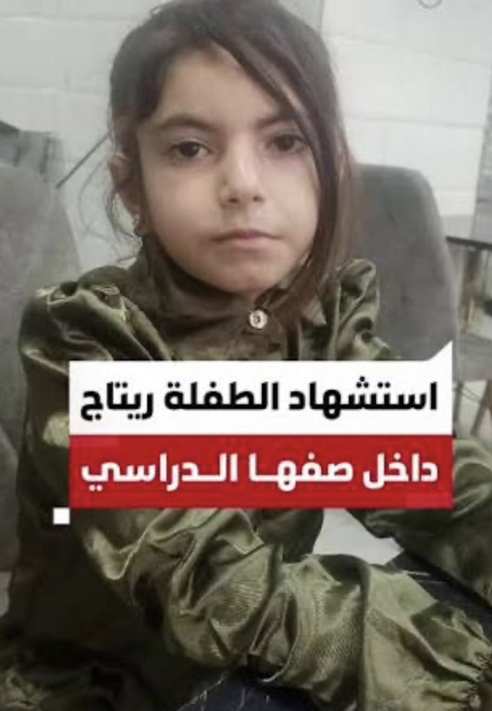 islambader_1988's tweet photo. كان الطفل خالد الاشرم يتلقى دروسه في نقطة تعليمية غرب مدينة غزة حين اصابته هذه الرصاصة الاسرائيلية!!

نجا خالد .. لكن ريتاج ريحان 9 اعوام لم تنجو حين اصابت الرصاصة رأسها خلال تلقيها دروسها في خيمة تعليمية شمال غزة! في 9 ابريل الماضي

لا يوجد مكان آمن في غزة .. https://t.co/XZru7em4JB