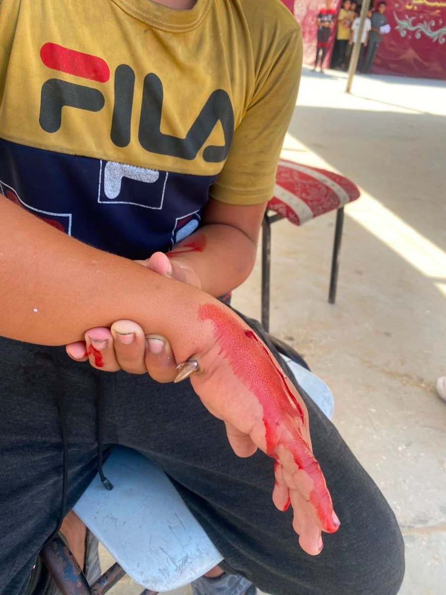 QudsNen's tweet photo. Breaking | A Palestinian student was injured by gunfire after Israeli forces opened direct fire at Al-Sawafir School, west of Gaza City. https://t.co/Bm2W6CdrTl