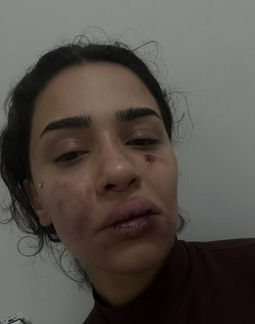 ww3mediaa's tweet photo. 🚨(HASSAS)

İstanbul'da yaşayan bir kadın, "Ölmek istemiyorum." diyerek M.M. isimli bir kişi tarafından uzun süredir psikolojik ve fiziksel şiddete maruz kaldığını açıkladı.

"Yaşadıklarım hiçbir zaman azalmadı; aksine zaman geçtikçe daha da ağırlaştı ve artık dayanamayacağım bir noktaya ulaştı.

Özellikle son zamanlarda ciddi boyutlara ulaşan ölüm tehditleri alıyorum.

Yaşadıklarımla ilgili hukuki başvurular yapıldı. Bundan sonraki süreç yalnızca hukuki yollar çerçevesinde ilerleyecektir."