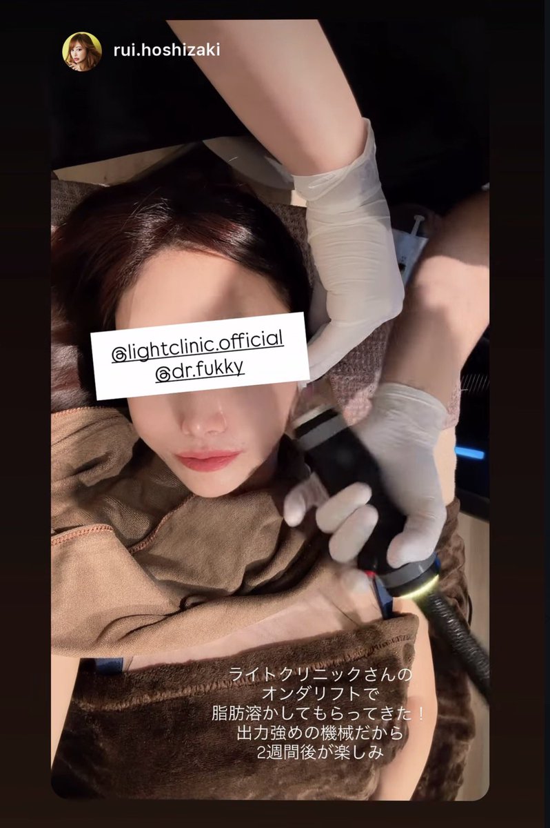 dr_fukky's tweet photo. 他院でオンダリフトの効果がなかった方！
一度ライトクリニックのオンダリフトを受けてみてください。 https://t.co/hHRcDRjgky