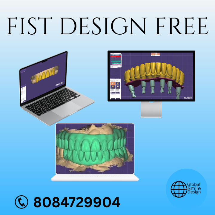 cglobaldesign's tweet photo. FIST DESIGN FREE
Outsource your CAD design to Global Design consultancy 
Please email us at: infoglobalsmiledesign@gmail.com
WhatsApp: +918084729904/+919955379813
#DentalCAD #DentalCAM #DentalDesign #zirconiadenrallab
#GlobalDesignConsultancy #GlobalSmileDesign #GlobalDentalLab https://t.co/RGFEwgfgOq