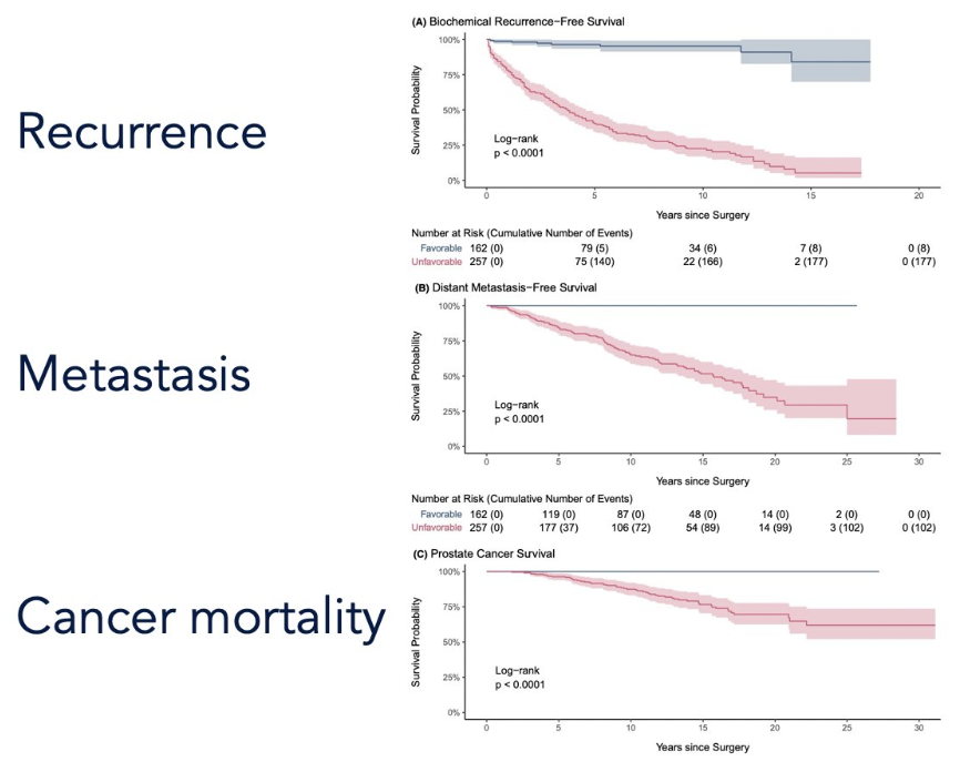 urotoday's tweet photo. Point-Counterpoint: đ§Ź Should molecular biomarkers encourage active surveillance in intermediate-risk prostate cancer?
@dr_coops @UCSFCancer at #USPCC26 says YESâfor the right patients.
Key points:
â
AS is already SOC for low-risk (GG1) disease; GG1 is an "incidentaloma" that rarely, if ever, metastasizes
â
Practice variation persistsâclinician preference still drives AS use despite guideline support
â
Intermediate-risk is heterogeneous: CAPRA (c-index ~0.76) + histologic features (cribriform, IDC, pattern 5) better stratify risk than NCCN buckets alone
â
Biomarkers add most value in borderline GG2/selected GG3 to support AS discussions; strongest data to date for Decipher GC
â
Emerging tools: Prolaris, @arteraAI, MPS2-AS urine assay, AI-pathology, liquid biopsies
Bottom line: AS decisions should be granular, individualized, and dynamic. Use biomarkers to reassure and select for AS in intermediate-riskânot to overtreat GG1.
Written coverage by @zklaassen_md @GACancerCenter. #ReadMore on UroToday > https://t.co/yZ7VsrfRFw @PCFnews @neerajaiims
