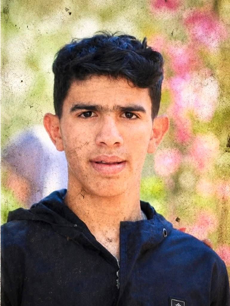 DropSiteNews's tweet photo. 🇵🇸 A 15-year-old Palestinian boy remains unconscious in intensive care and may lose his right foot after Israel denied him treatment in prison as his health collapsed, the Palestinian Prisoners’ Club said.

Mohammed Hamid developed scabies in Israeli custody, but prison authorities withheld necessary care even as his condition deteriorated. He was then returned to prison in critical condition, where severe infections spread to his heart and brain.

Only after he reached a life-threatening stage did Israeli authorities release him, in what the group described as an attempt to escape responsibility. Mohammed is now unconscious at Shaare Zedek Hospital, with doctors considering the amputation of his right foot.

The Prisoners’ Club said his case reflects a systematic Israeli policy of using medical neglect and deprivation of treatment as tools of “slow killing” against Palestinian prisoners, including children, within a prison system of torture and abuse that has escalated sharply since the start of the genocide.