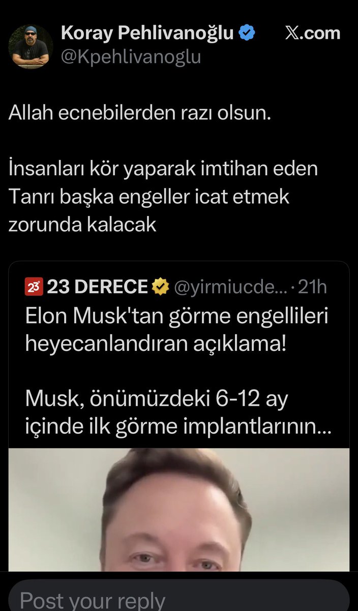 OmerAtillaErgi's tweet photo. Bir ateistin, tanrıyı insanları kör yapmakla suçlaması felsefi bir paradokstur.

Bilimsel başarı için tanrıyı inkar etmek gerek diyorsanız, kendi bilimsel başarılarınızı yazın.

Ateist olunca kansere çare mi buldunuz? 
Mars’a mekik mi gönderdiniz?
Fizikte Nobel ödülü mü aldınız? https://t.co/eaOtUwJEQA