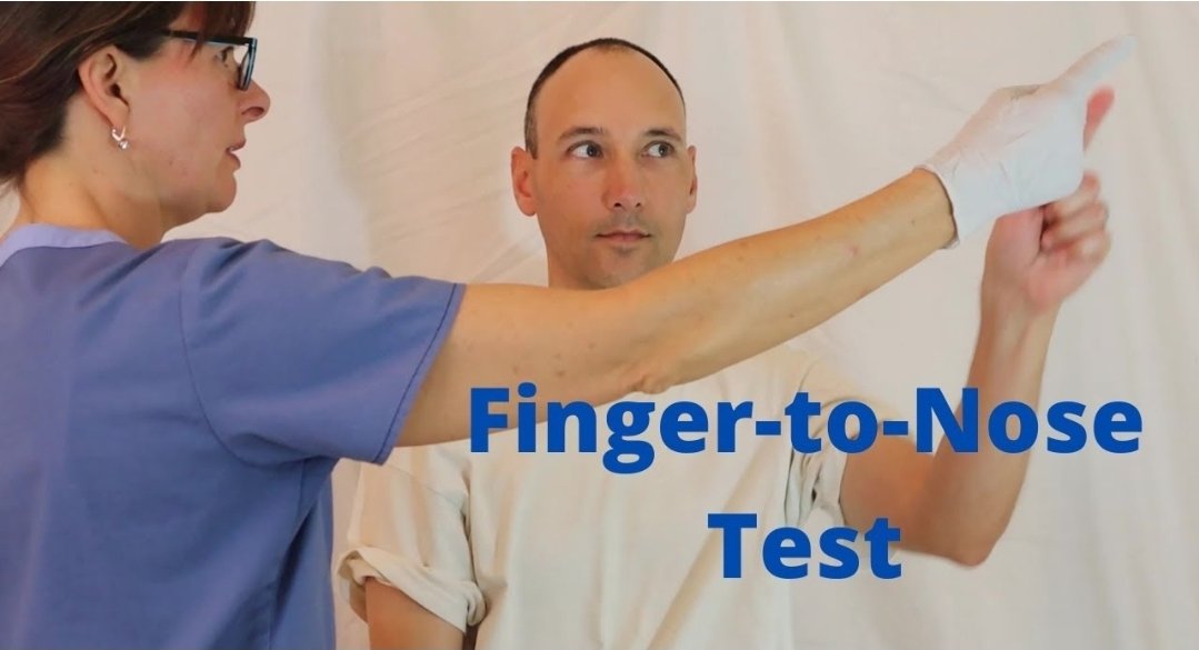 P_milk's tweet photo. #알쓸신잡 알면 쓸때있는 신기한 잡지식

[핑거투노즈테스트]
Finger-to-Nose Test는 신경학적 검사 중 하나로, 소뇌(小腦) 기능과 상지 협응력, 고유수용감각을 평가하는 간단한 테스트입니다.

"트윗에 나온 의사 분의 사례처럼, 갑자기 어지러움이 생겼을 때 본인이 스스로 해보는 경우도 있지만, 병원에서 의사가 공식적으로 시행하는 방식은 조금 더 체계적입니다."

✅️검사 방법 (임상에서 하는 표준 방식)
1. 환자는 앉거나 선 자세를 취합니다.
2. 의사가 자신의 검지 손가락을 환자 앞 팔 길이 정도에 내밀고 고정합니다.
3. 환자는 "자신의 검지 손가락"으로  
 - 의사의 손가락 끝을 만지고  
 - 이어서 자신의 "코끝"을 만지는 동작을 번갈아 반복합니다.
4. 의사는 손가락 위치를 여러 방향(위·아래·좌·우)으로 옮기면서 반복하게 합니다.
5. 양쪽 손 모두 시행합니다.
6. 필요하면 "눈을 감고" 같은 동작을 하게 해서 고유수용감각을 더 정확히 평가합니다.

💡정상 vs 비정상
- 정상 : 손가락이 목표물(코끝이나 의사 손가락)을 정확하고 부드럽게 찾아갑니다.
- 비정상 소견:
- 실조(dysmetria) : 목표물을 지나치거나(과다측정) 못 미침(과소측정)
- 의도 진전(intention tremor) : 목표물에 가까워질수록 손이 떨림
- 동작이 서툴고 불안정함

이런 소견이 나타나면 "소뇌나 그와 연결된 신경 경로에 문제"가 있을 가능성을 시사합니다. 특히 갑자기 어지러움과 함께 나타난다면 뇌경색(특히 소뇌 또는 후순환 뇌졸중)을 의심할 수 있는 중요한 단서가 됩니다.

🚨이 테스트만으로 뇌졸중을 진단할 수는 없습니다. 갑자기 심한 어지러움, 한쪽 팔다리 힘 빠짐, 발음 이상, 시야 장애 등이 동반되면 "즉시 119를 부르거나 응급실로 가야 합니다." 자가 테스트 결과만으로 안심하거나 방치하면 안 됩니다.