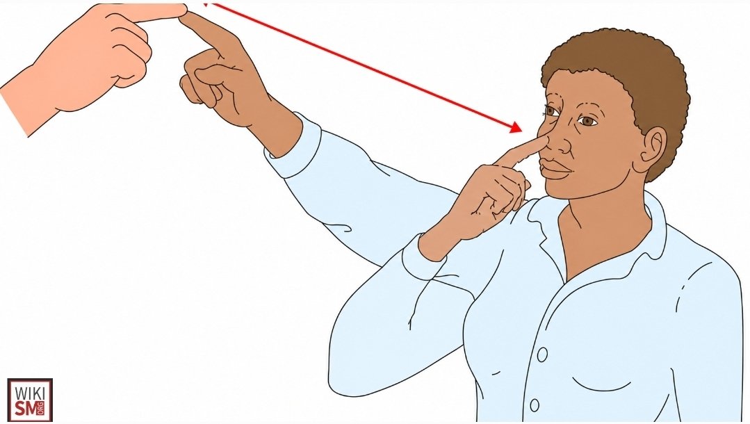 P_milk's tweet photo. #알쓸신잡 알면 쓸때있는 신기한 잡지식

[핑거투노즈테스트]
Finger-to-Nose Test는 신경학적 검사 중 하나로, 소뇌(小腦) 기능과 상지 협응력, 고유수용감각을 평가하는 간단한 테스트입니다.

"트윗에 나온 의사 분의 사례처럼, 갑자기 어지러움이 생겼을 때 본인이 스스로 해보는 경우도 있지만, 병원에서 의사가 공식적으로 시행하는 방식은 조금 더 체계적입니다."

✅️검사 방법 (임상에서 하는 표준 방식)
1. 환자는 앉거나 선 자세를 취합니다.
2. 의사가 자신의 검지 손가락을 환자 앞 팔 길이 정도에 내밀고 고정합니다.
3. 환자는 "자신의 검지 손가락"으로  
 - 의사의 손가락 끝을 만지고  
 - 이어서 자신의 "코끝"을 만지는 동작을 번갈아 반복합니다.
4. 의사는 손가락 위치를 여러 방향(위·아래·좌·우)으로 옮기면서 반복하게 합니다.
5. 양쪽 손 모두 시행합니다.
6. 필요하면 "눈을 감고" 같은 동작을 하게 해서 고유수용감각을 더 정확히 평가합니다.

💡정상 vs 비정상
- 정상 : 손가락이 목표물(코끝이나 의사 손가락)을 정확하고 부드럽게 찾아갑니다.
- 비정상 소견:
- 실조(dysmetria) : 목표물을 지나치거나(과다측정) 못 미침(과소측정)
- 의도 진전(intention tremor) : 목표물에 가까워질수록 손이 떨림
- 동작이 서툴고 불안정함

이런 소견이 나타나면 "소뇌나 그와 연결된 신경 경로에 문제"가 있을 가능성을 시사합니다. 특히 갑자기 어지러움과 함께 나타난다면 뇌경색(특히 소뇌 또는 후순환 뇌졸중)을 의심할 수 있는 중요한 단서가 됩니다.

🚨이 테스트만으로 뇌졸중을 진단할 수는 없습니다. 갑자기 심한 어지러움, 한쪽 팔다리 힘 빠짐, 발음 이상, 시야 장애 등이 동반되면 "즉시 119를 부르거나 응급실로 가야 합니다." 자가 테스트 결과만으로 안심하거나 방치하면 안 됩니다.