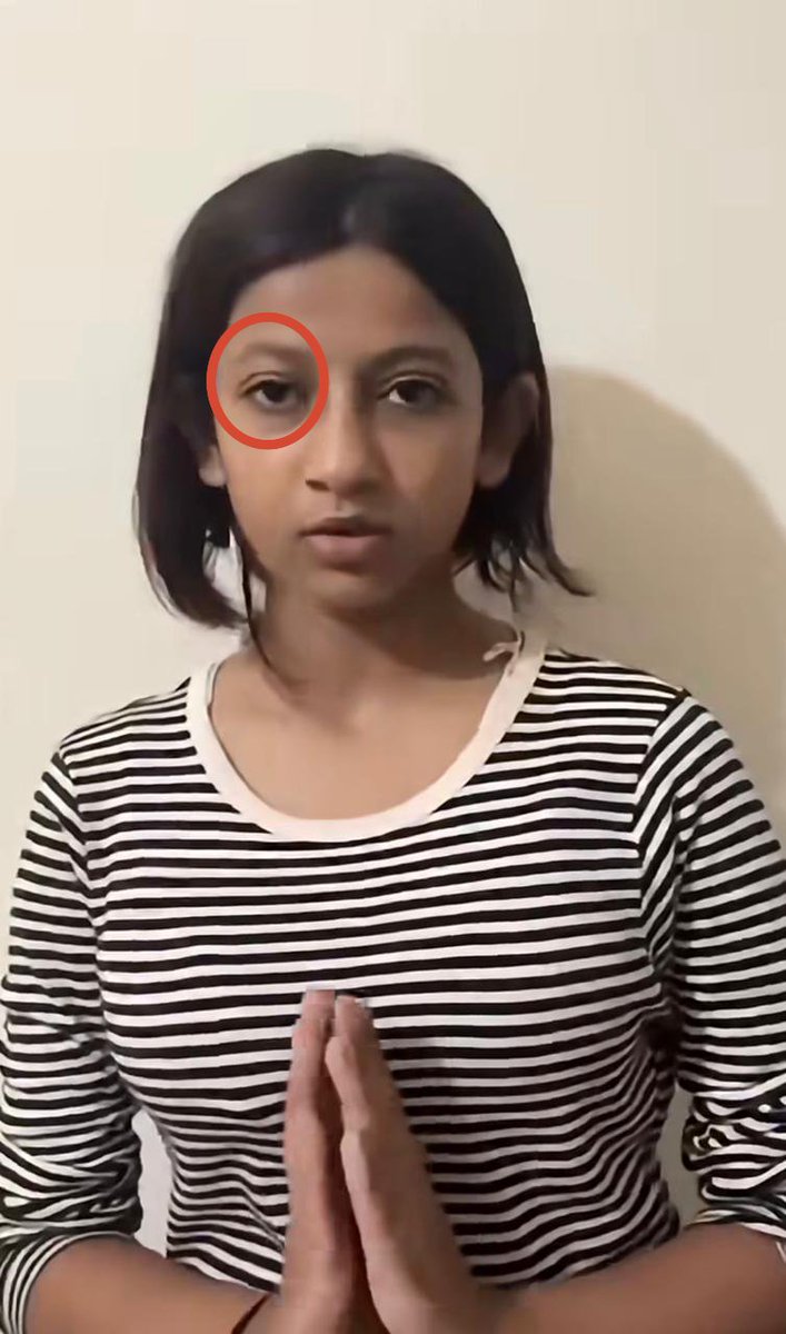ishita_9529's tweet photo. जंतर मंतर वाली Ruchika Singh ने बड़ी चालाकी से मोदी और नोएडा पुलिस को मूर्ख बनाया।

सहानुभूति के लिए रुचिका ने अपनी छोटी बहन से वीडियो बनाकर पूरा मामला ही पलट दिया।

Ruchika अभी 25 साल की है और उसकी छोटी बहन उम्र में 10 साल छोटी है रुचिका की मां ने मासूम बनकर वीडियो...Open news https://t.co/9QtIjd6Dcn