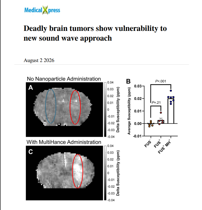 SOUND WAVES OPEN THE BLOOD-BRAIN BARRIER Focused ultrasound and