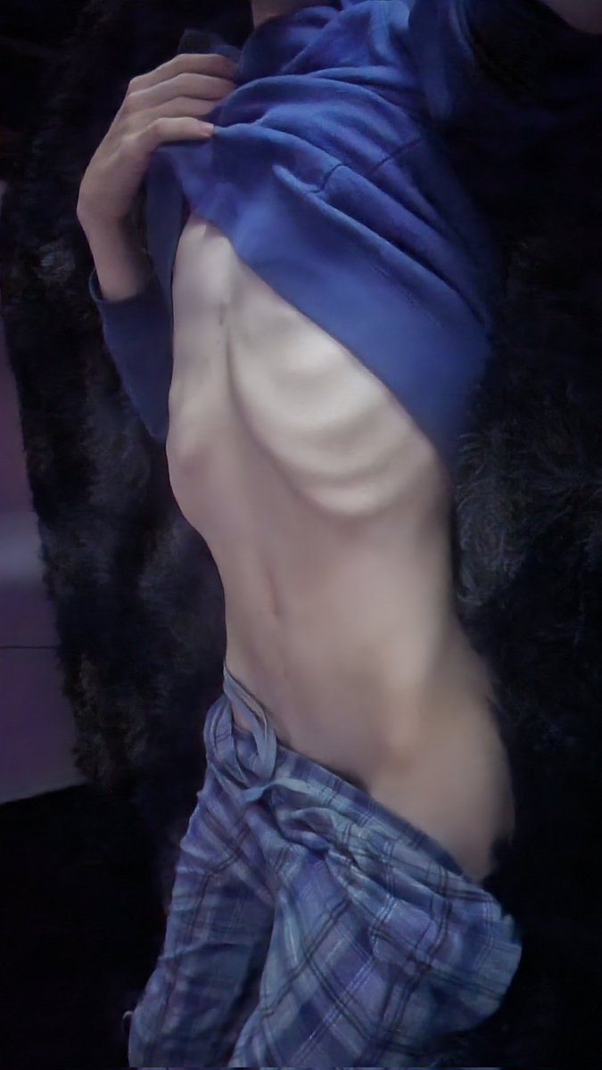stinnk_6's tweet photo. Im just skin and bone https://t.co/GCbbmjW6Ew