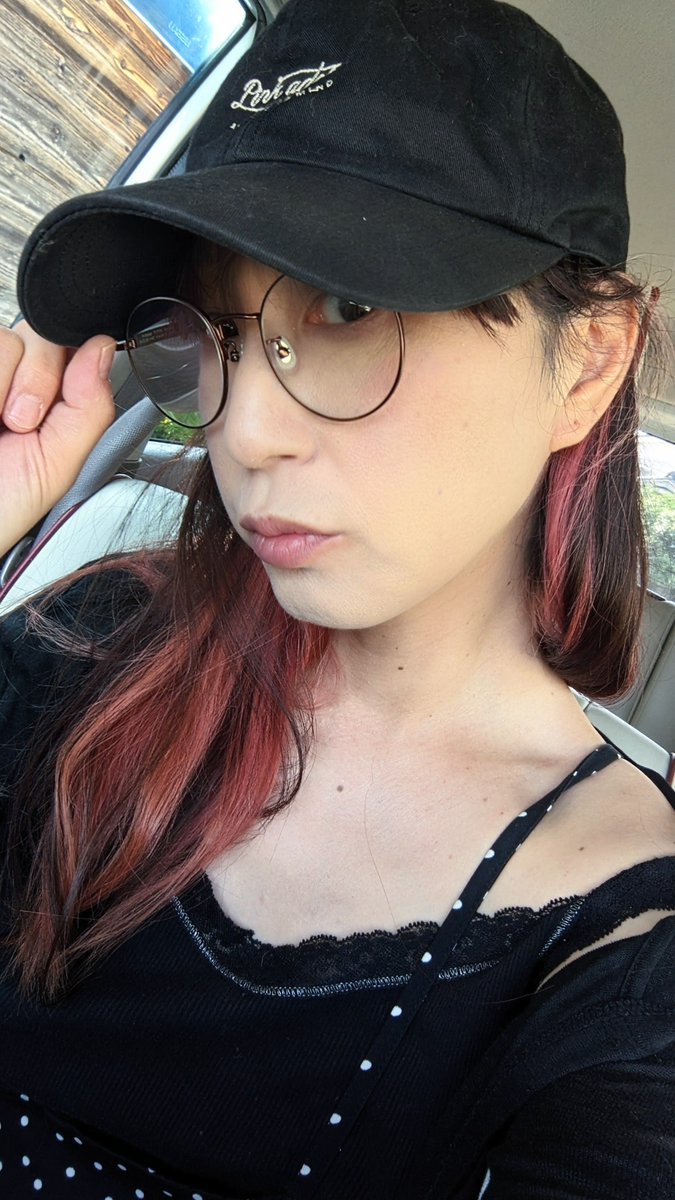 treemate01's tweet photo. セルフでピーリングやっても結局外でなきゃいけないし余計にシミになるし肌荒れするし、まぁ肌荒れはそれをやってると言うか効果のうちなんだろうけどやっぱ続かない。いつもボロボロになって二度としないと思うけど、定期的にやってしまうと言う…けど一瞬キレイにはなる気がします。ねぇ良いのない？ https://t.co/fVyPWpJ3pQ