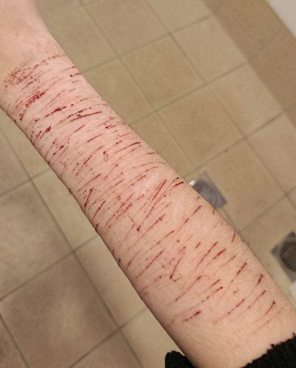 spikyceilingfan's tweet photo. I stole a bunch of glass from art therapy it's all dull as shit but it's the only way I can get through the meals 🥲 I desperately need it to be sharper or I might go crazy https://t.co/zJydXmsTFp