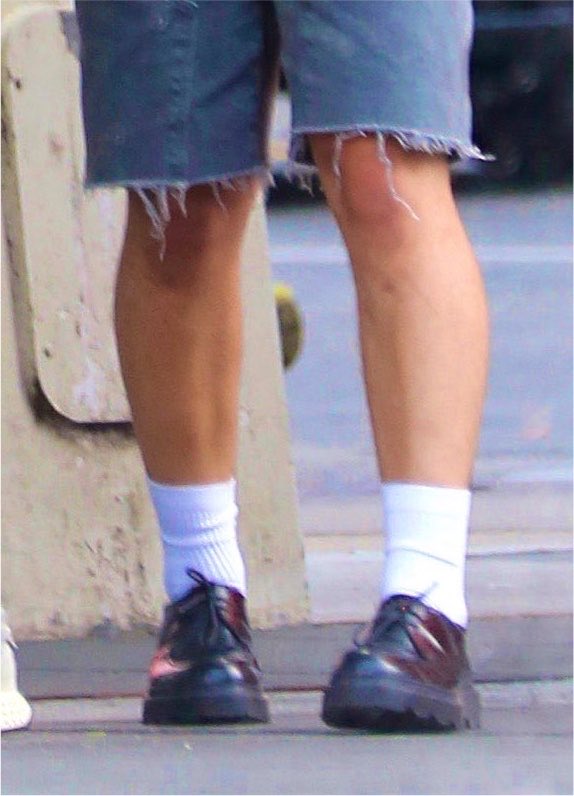 dsbuckleys's tweet photo. pigeon toed https://t.co/gUlz7VoJxg