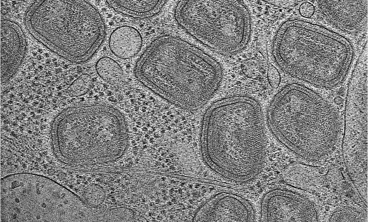 IBMScience's tweet photo. New research has revealed how poxviruses release their genetic material into infected cells, using advanced imaging and AI to uncover a potential target for future antiviral drugs.

Read more: https://t.co/FqTbq3ONSp https://t.co/qukr5tNPiB