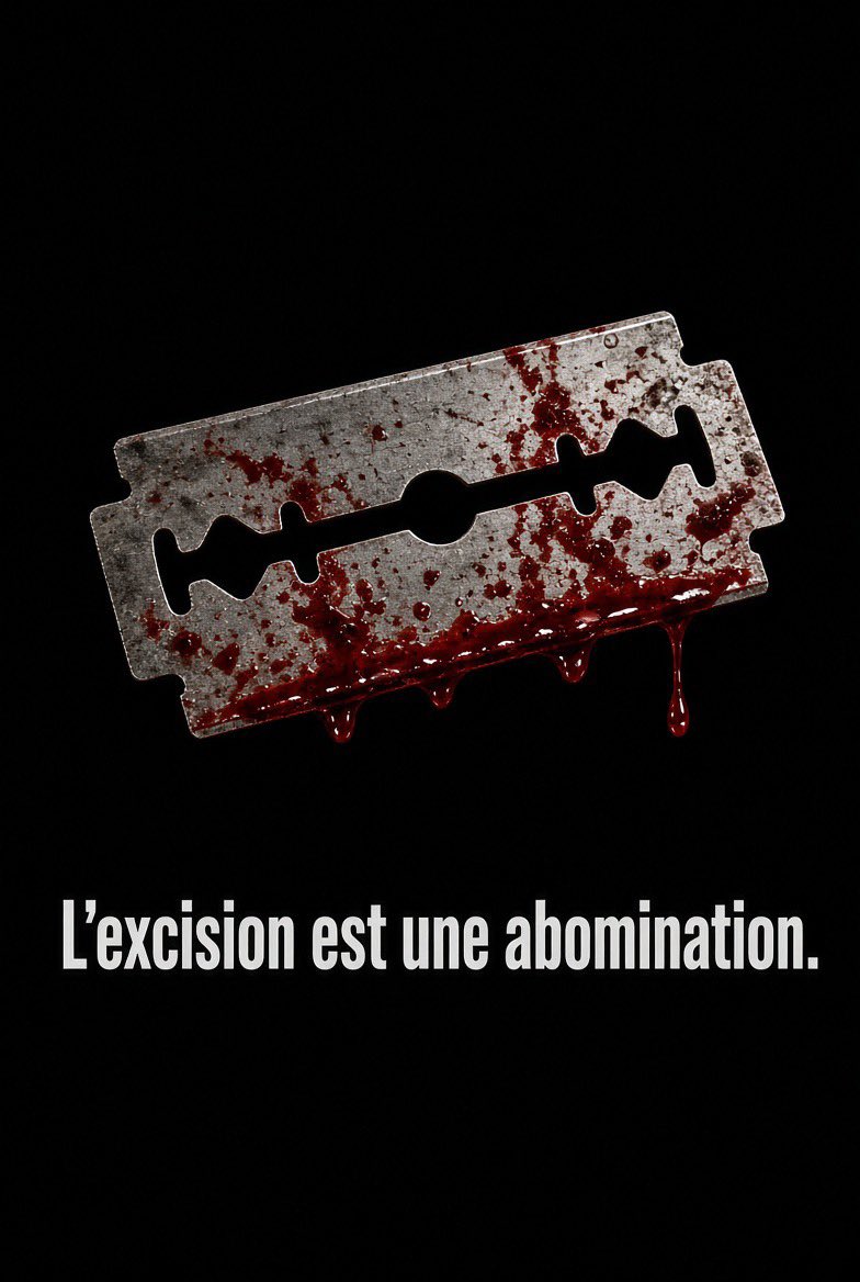 alainpaulweber's tweet photo. Je refais un tweet sur l’excision parce que j'ai été effaré et écœuré d'apprendre qu’en Seine Saint-Denis, 10 pour cent des jeunes filles seraient excisées.

C’est un crime.

 Alors je veux en parler, encore…

L'horreur silencieuse : ces fillettes mutilées au nom de la tradition

C'est une réalité que l'on préfère ignorer, détourner le regard. 

Une mutilation qui consiste en l'ablation partielle ou totale du clitoris, parfois accompagnée de l'excision des petites lèvres, voire de leur couture.

Le scénario est presque toujours identique. Des fillettes, parfois âgées de quelques semaines seulement, et jusqu’à 10 ou 12 ans, sont emmenées en Afrique sous prétexte de vacances familiales. 

Là-bas, loin des regards, l'irréparable est commis. Puis elles reviennent, silencieuses, traumatisées, avec des séquelles physiques et psychologiques à vie.

Les conditions dans lesquelles ces opérations sont pratiquées défient l'entendement. 

Dans la très grande majorité des cas, aucun professionnel de santé n'est présent. 

Les outils utilisés sont ceux du quotidien détournés de leur usage : lames de rasoir, ciseaux non stérilisés, tessons de bouteille, couteaux de cuisine. Pas d'anesthésie, pas d'asepsie, pas de soins post-opératoires.

Les petites filles sont maintenues de force par plusieurs femmes du village, parfois leurs propres mères ou grands-mères. 

Les cris, les hurlements, la douleur atroce, tout cela est étouffé, banalisé, considéré comme un passage obligé.

Les conséquences sont dévastatrices : hémorragies massives, infections généralisées, tétanos, transmission de maladies par des instruments souillés. 

Sans parler des complications à long terme : douleurs chroniques, kystes, problèmes urinaires, rapports sexuels douloureux, complications lors des accouchements, et un traumatisme psychologique qui ne guérit jamais vraiment.

Cette pratique n'a rien à voir avec la religion, contrairement à ce que certains prétendent. Elle n'est mentionnée ni dans le Coran ni dans la Bible. Elle est le fruit de traditions visant à contrôler la sexualité féminine, perpétuées de génération en génération.

La France n’a pas fait suffisamment de la lutte contre les mutilations sexuelles féminines une priorité. Des lois existent, mais le phénomène persiste, alimenté par la pression familiale et communautaire.

Il est temps de briser ce silence assourdissant. Chaque excision est une atteinte irréversible à l'intégrité d'une enfant. Chaque année, des milliers de fillettes sont sacrifiées sur l'autel de traditions barbares.