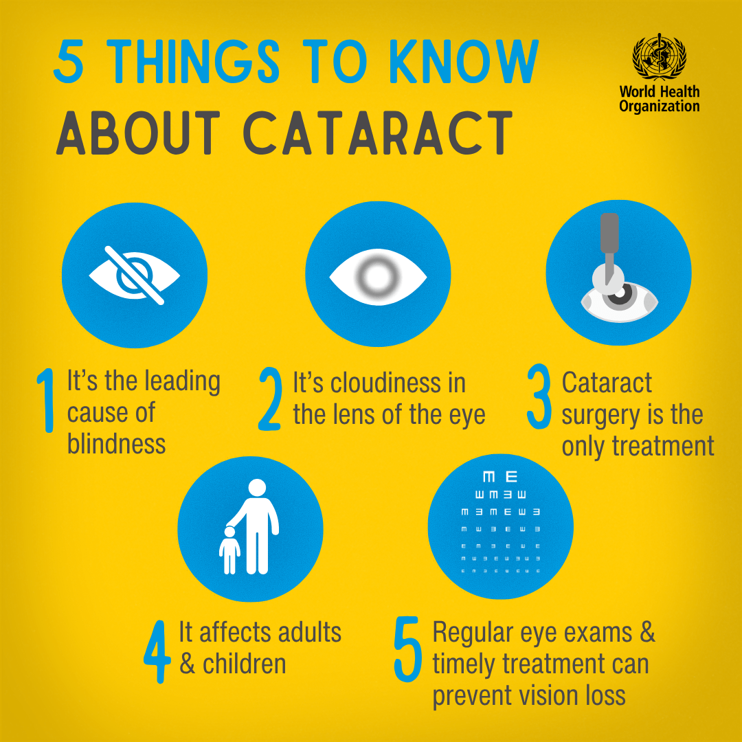 WHO's tweet photo. Cataract is one of the leading causes of vision impairment and blindness, affecting 94 million people worldwide.

Don’t take your eyes for granted. Regular eye exams and timely treatment can prevent vision loss. Learn more 👉 https://t.co/LBMAmiegVg https://t.co/FzkSeGLJ6e