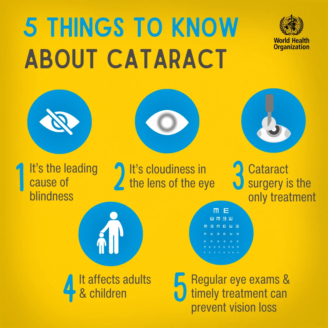 Infographic titled “5 Things to Know About Cataract”. It lists:

- It’s the leading cause of blindness.
- It’s cloudiness in the lens of the eye.
- Cataract surgery is the only treatment.
- It affects adults and children.
- Regular eye exams and timely treatment can prevent vision loss.