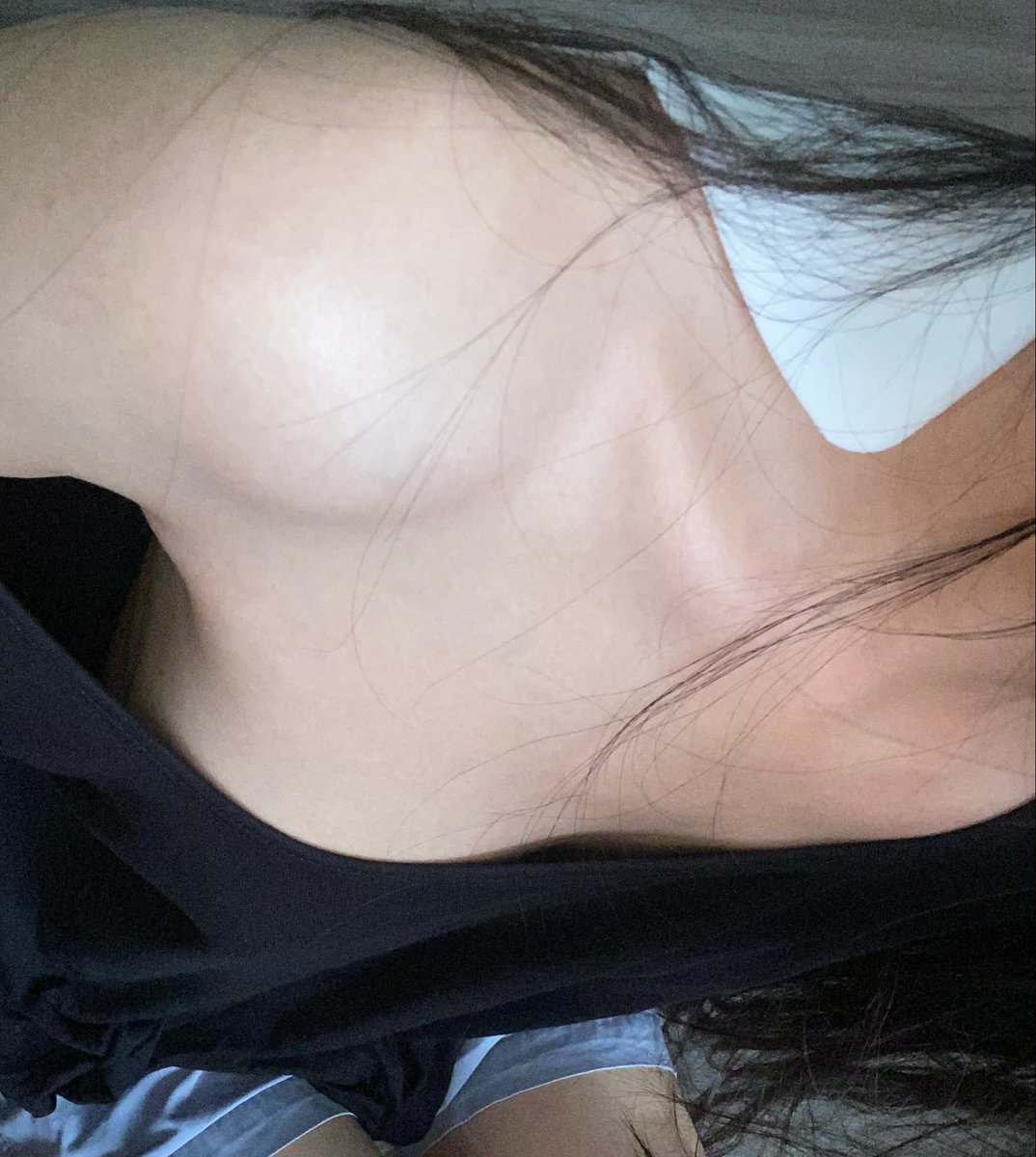 elmbeluna's tweet photo. woke up with a sore shoulder https://t.co/oQWFbSmRo0