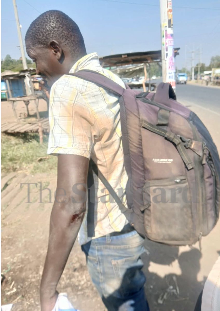 StandardKenya's tweet photo. Kisumu-based AFP correspondent Fred Ooko was attacked and beaten by goons in Homa Bay Town while covering the Linda Mwananchi rally. His camera and driving licence were also taken during the incident.

Photo: Rodgers Otiso https://t.co/Lgp6vZkZ7t