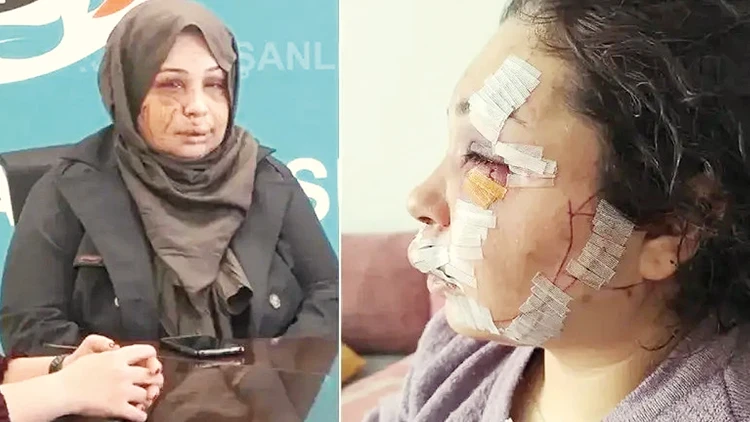 Hurriyet's tweet photo. ◾️Kendisinden boşanmak isteyen eşi Fatma Çakmak’a saldırarak yüzünü kesen polis memuru Yasin Çakmak’a verilen 7 yıl 6 ay hapis cezası, “İstesem öldürebilirdim” savunması ve iyi hal indirimiyle 4 yıl 2 aya düşürüldü. 

Arbedede eşini bıçakla elinden yaralayan Fatma Çakmak ise 2 yıl 6 ay ceza aldı.

🖊️@mesuthasanbenli

🔗https://t.co/vHJLIcaFix