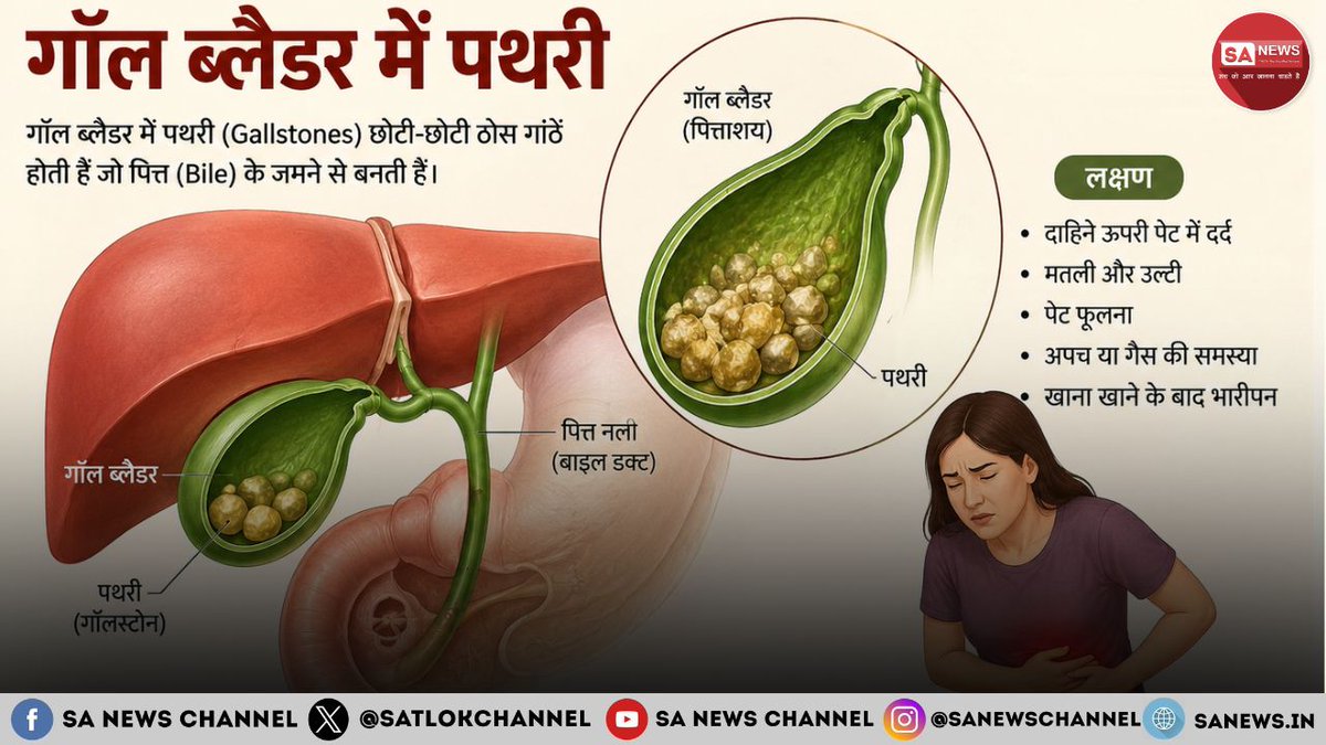 SatlokChannel's tweet photo. पेट के दाहिने ऊपरी हिस्से में अचानक तेज दर्द को हमेशा गैस समझकर नजरअंदाज न करें। यह गॉल ब्लैडर की पथरी का संकेत हो सकता है। इसके साथ उल्टी, बुखार या पीलिया जैसे लक्षण गंभीर स्थिति की ओर इशारा कर सकते हैं। अल्ट्रासाउंड से इसकी पहचान की जा सकती है। लक्षण होने पर डॉक्टर उपचार की सलाह देते हैं। स्वस्थ वजन, संतुलित आहार और नियमित व्यायाम से जोखिम कम किया जा सकता है: https://t.co/o01bLZZZkU  | Read on Instagram: Link in Bio 

#GallbladderStone #HealthTips #Gallstones #HealthAwareness