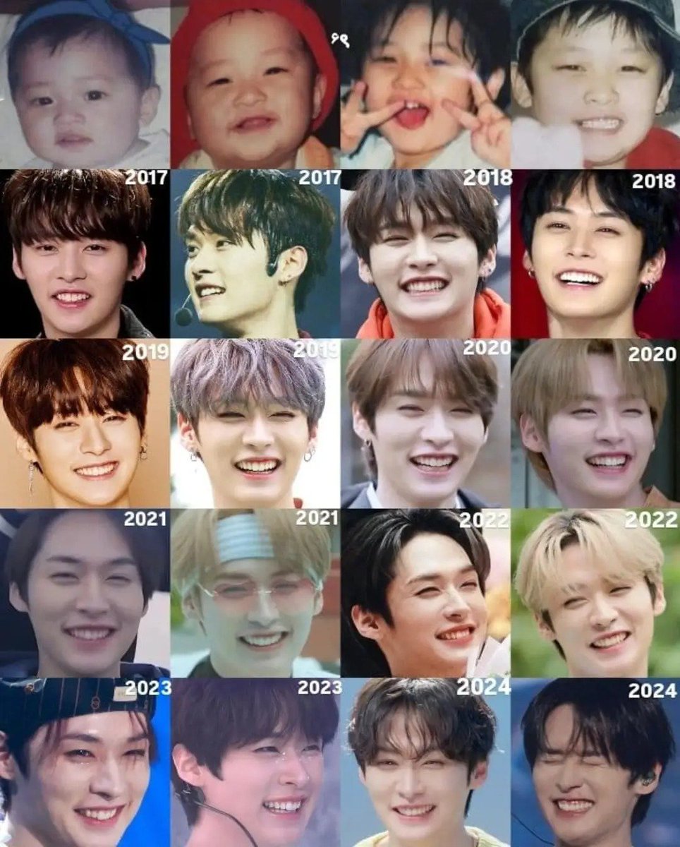 knowccity's tweet photo. Oh baby, Lee Know’s had that perfect face since he was literally in his mama’s womb! No surgery could ever give you a nose, that bunny smile, and a face this perfect. Cry about it, his face still looks the same as it did 10 years ago 😭🫶 https://t.co/BCzNAKP7Fn