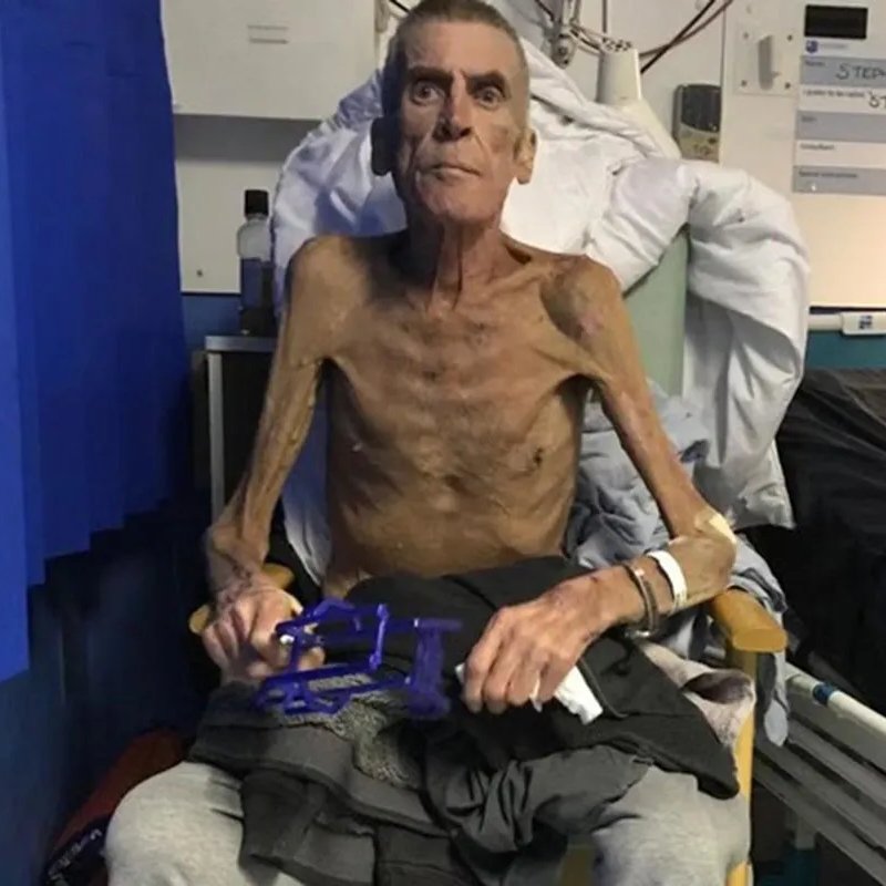 dave43law's tweet photo. The UK democide of the disabled - Reform policy title

Steve should be the poster boy of Reform's disability campaign

"In 2017, just one year after the start of the benefit freeze, Stephen Smith, who suffered from chronic obstructive pulmonary disease and osteoarthritis, had his Employment Support Allowance (ESA) payments stopped. A work capability assessment (WCA) found 64-year-old Stephen “fit for work”."

JENRICK WAS PART OF THAT GOVERNMENT