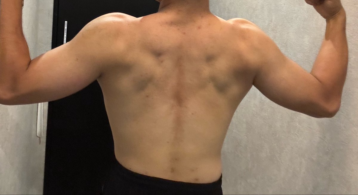 HagMetakuya's tweet photo. 背中トレ➕デッドリフト！！

筋トレやる前にパワーグリップが行方不明やったけどジムスタッフが拾ってくれてたみたいで見つかって良かった💪💪💪

久しぶりのダンベルロウは中々きつかった🥲

#筋トレ
#筋トレ好きと繋がりたい
#筋トレ垢 https://t.co/xOHR5zXWV6