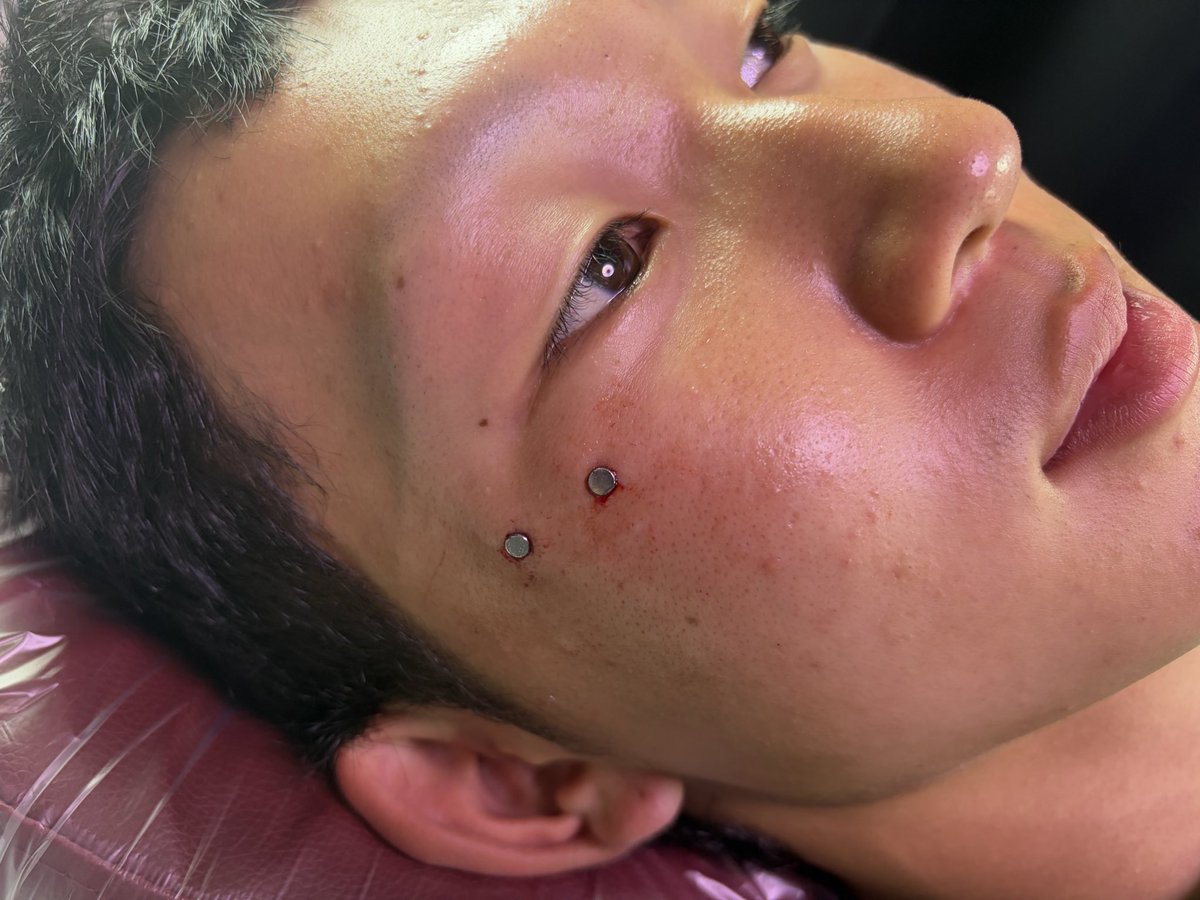 96Olver_pf's tweet photo. .
アンチアイブロウ
マイクロダー���ル

#ピアス
#piercing
#ピアススタジオ
#アンチアイブロウ
#マイクロダーマル https://t.co/AKiMcTiifh