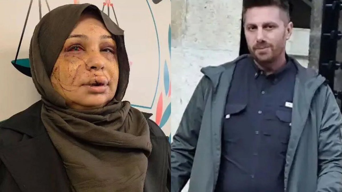 ToplumsalMht111's tweet photo. “İstesem öldürebilirdim” savunmasına iyi hal indirimi

Eşi Fatma Çakmak’ı boşanmak istediği için darp edip yüzünü kesen Cumhurbaşkanı Koruma Dairesi personeli Yasin Çakmak’ın cezası, mahkemede yaptığı “İstesem öldürebilirdim” savunması ve iyi hal indirimiyle 7 yıl 6 aydan, 4 yıl 2 aya düşürüldü. 

Saldırı anında fail Yasin Çakmak’ı bıçakla elinden yaralayan Fatma Çakmak ise 2 yıl 6 ay ceza aldı.