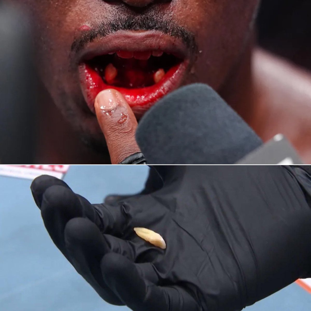 InTheCagePL's tweet photo. Ała... 🥶
Tresean Gore przekonał się, że zwycięstwo w oktagonie UFC może naprawdę wiele kosztować...

🛑 Zawodnik zwyciężył decyzją z Vicente Luque na #UFC330, ale jedno z latających kolan rywala pozbawiło go części uzębienia... https://t.co/zL9i6EZmIm