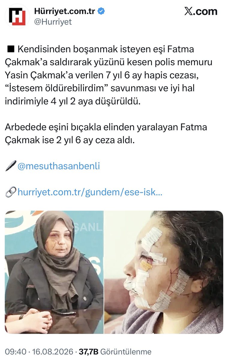 nasuhbektas's tweet photo. Söyleyecek sözü olan var mı ? 
Özellikle AKP ve MHP’de siyaset yapan kadınlar ?
Boşanmak isteyen eşi Fatma Çakmak’a,  saldırarak yüzünü kesen cumhurbaşkanlığı koruma şubede görevli polis memuru Yasin Çakmak’ın kadına karşı tehdit suçundan beraatine karar verdi. 
Yasin Çakmak‘a eşini kasten yaralamadan verilen  7 yıl 6 aylık hapis cezası, istesem öldürebilirdim savunması ve iyi hal, haksız tahrik indirimleri ile 4 yıl 2 aya düşürülüp Yasin Çakmak tahliye edildi. 

Arbede esnasında kocası Yasin Çakmak’ın elini yaralayan Fatma Çakmak ise 2 yıl 6  ay hapis cezası aldı. 

Sanırım sadece öldürmediği için teşekkür etmedikleri kalmış.