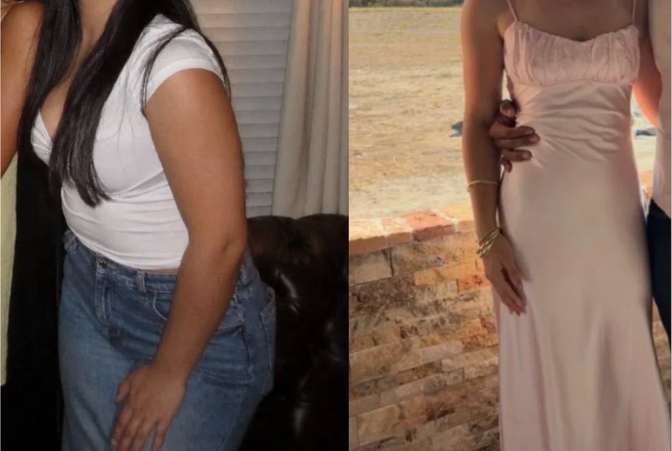 Six months of retatrutide