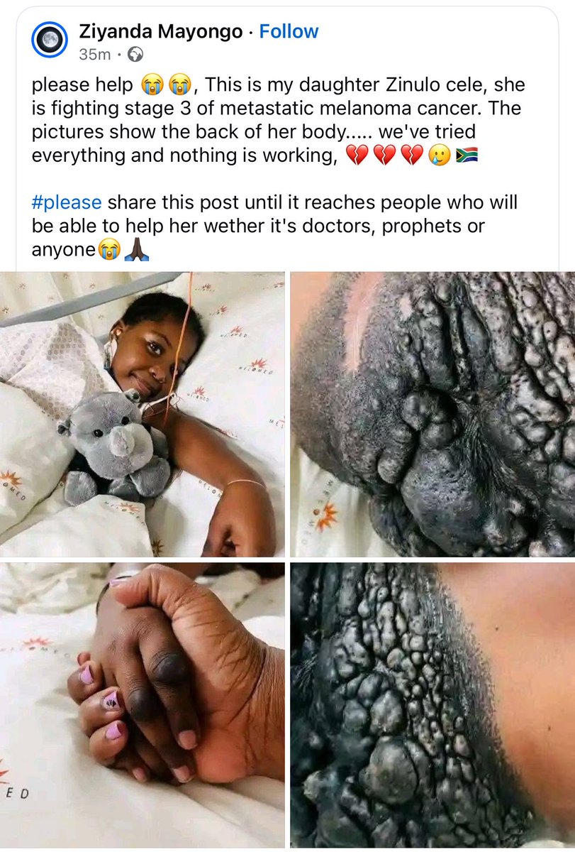 nubian6's tweet photo. Please share to save this little girl’s life https://t.co/9JOL4AUEUB