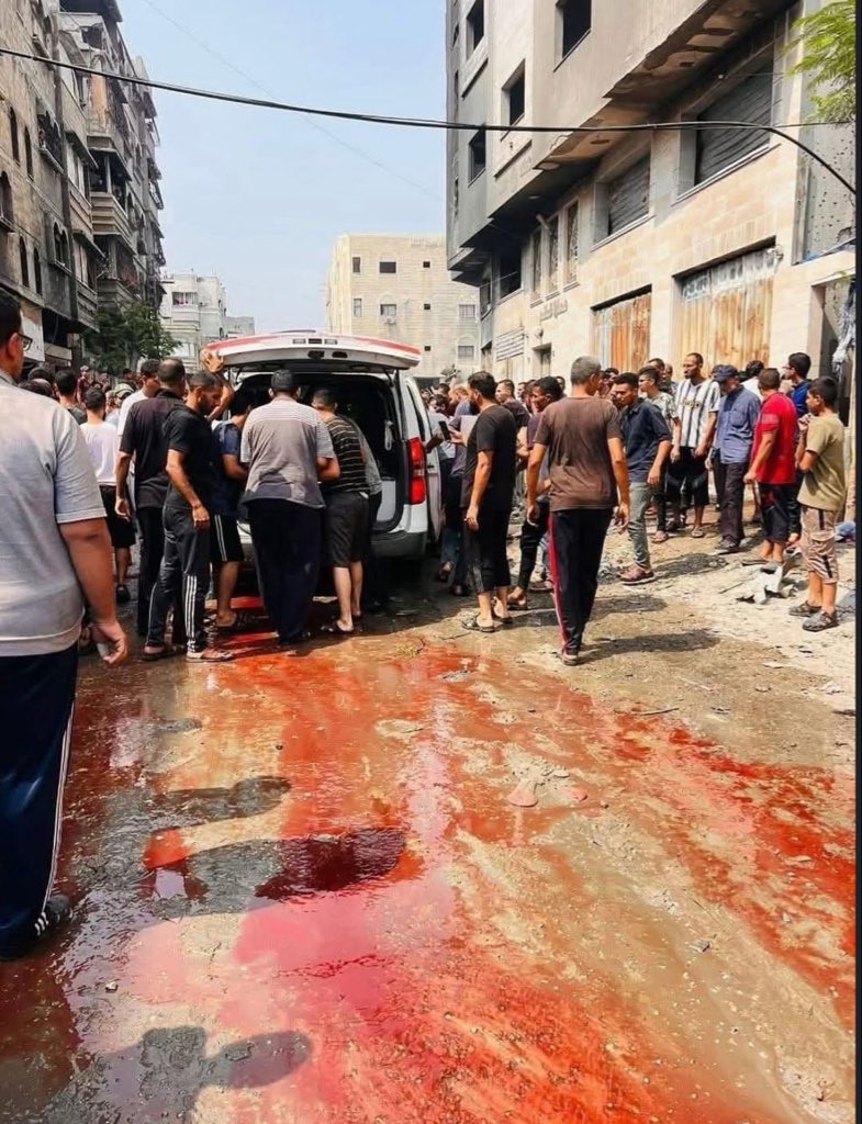 AbujomaaGaza's tweet photo. Blood rivers in Gaza.. No one cares about our suffering and pain https://t.co/WGcsAcMe0u