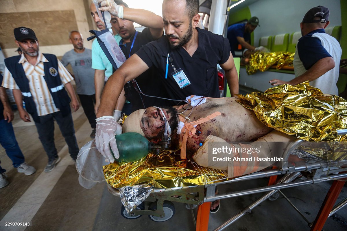 AhmadHasaballa3's tweet photo. KHAN YUNIS, GAZA - AUGUST 16: A child injured in an airstrike arrives at Nasser Hospital on August 16, 2026 in Khan Yunis, Gaza. An Israeli airstrike reportedly targeted a tent for displaced Palestinians on Sunday. (Photo by Ahmad Hasaballah/Getty Images) https://t.co/mEPjMovy7j