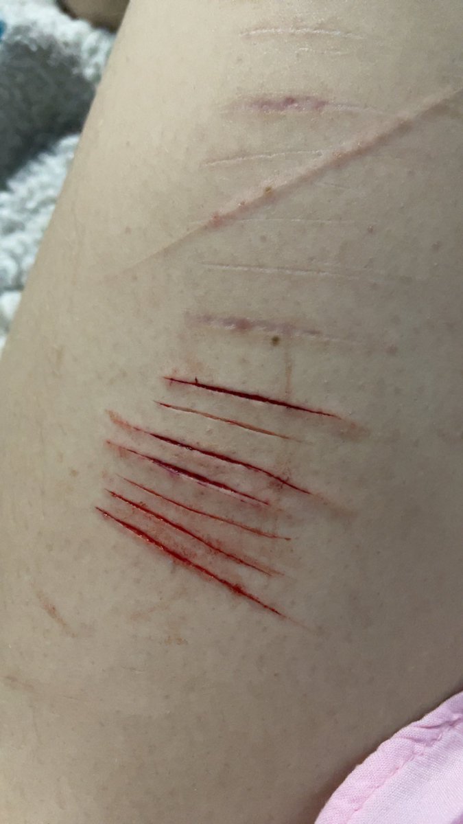kelp330's tweet photo. I miss my kai razors they were so good :(

all fake sfx makeup https://t.co/u3e5AumqBn