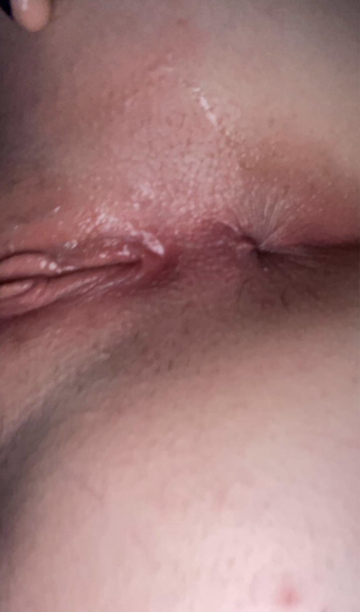 queenngapee's tweet photo. Who wants to suck my cum pump holes #goon #anallover #nsfwtwt #teenasshole #analslut #teenhole #queengape #teenpussy #teen #pussyspread #asshole #feet #hole #yungho #youngho #goodgirl #anallove #teenholes #gooner #goonette #porn #lesbian #horny #teenslut #teenporn https://t.co/wpga8QAOza
