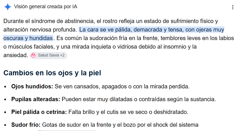 OscarCuesta14's tweet photo. @FisicoImpuro le he echo esta pregunta a la IA 
¿Como es el rostro de un drogadicto cuando tiene abstinencia?
y me ha respondido con estos datos
comparen y Saquen ustedes conclusiones https://t.co/3vwYOtgV5c