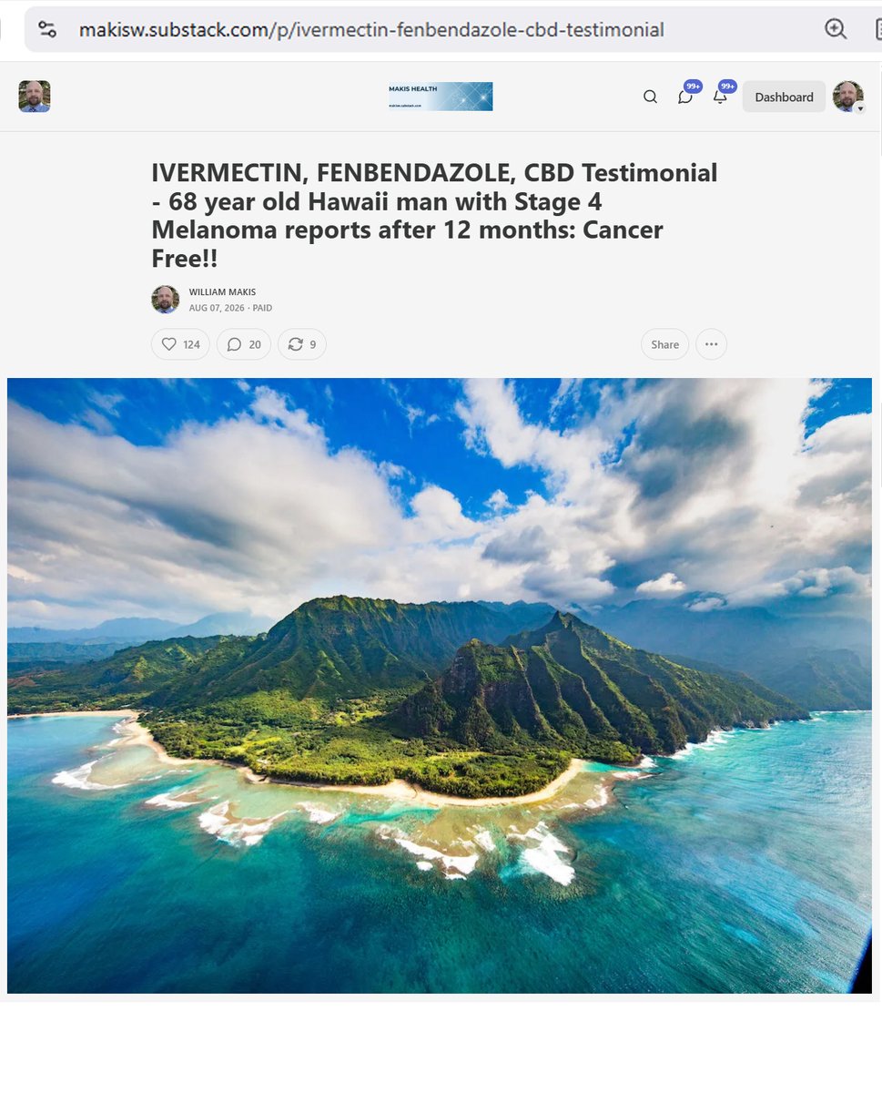 MakisMedicine's tweet photo. NEW ARTICLE: IVERMECTIN, FENBENDAZOLE, CBD Testimonial - 68 year old Hawaii man with Stage 4 Melanoma reports after 12 months: Cancer Free!!

Ivermectin Cancer Revolution sweeping Hawaii! 😃

STORY:
68 year old Hawaii man with Stage 4 Melanoma

In July 2025 he started:

Ivermectin 1mg/kg/day
Fenbendazole 1000mg/day
CBD Oil 100mg/day

Results after 1 year: Cancer Free!

"I had tumors in my left lung with a large tumor on my left femur; the cancer was also in my right shoulder, left rib cage, hips and back."

"Now, back to my results from this week: the PET scan showed NO TUMORS and it also showed no active cancer anywhere in my body"

Melanoma is a very difficult cancer.

Oncologists boast about new immunotherapies but there are too many melanoma patients who progress rapidly with Stage 4 on mainstream treatments alone.

Treatment synergy with Ivermectin and Fenbendazole can work wonders in aggressive melanoma and case series are being prepared for publication.

I have helped over 9000 Cancer patients with Ivermectin, Mebendazole and Fenbendazole in the largest "Right to Try" Research Project on earth.  

Florida will soon be the global center of Cancer Research into Treatment Synergy with repurposed drugs, stay tuned for more announcements! 😃