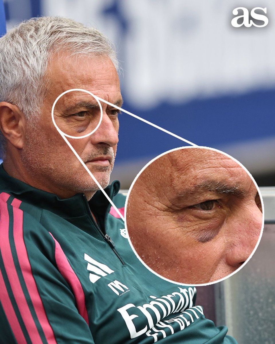 MadridXtra's tweet photo. 🚨 José Mourinho got a black eye due to being hit by a ball during training. @AranchaMOBILE https://t.co/zC7XlTCdaX