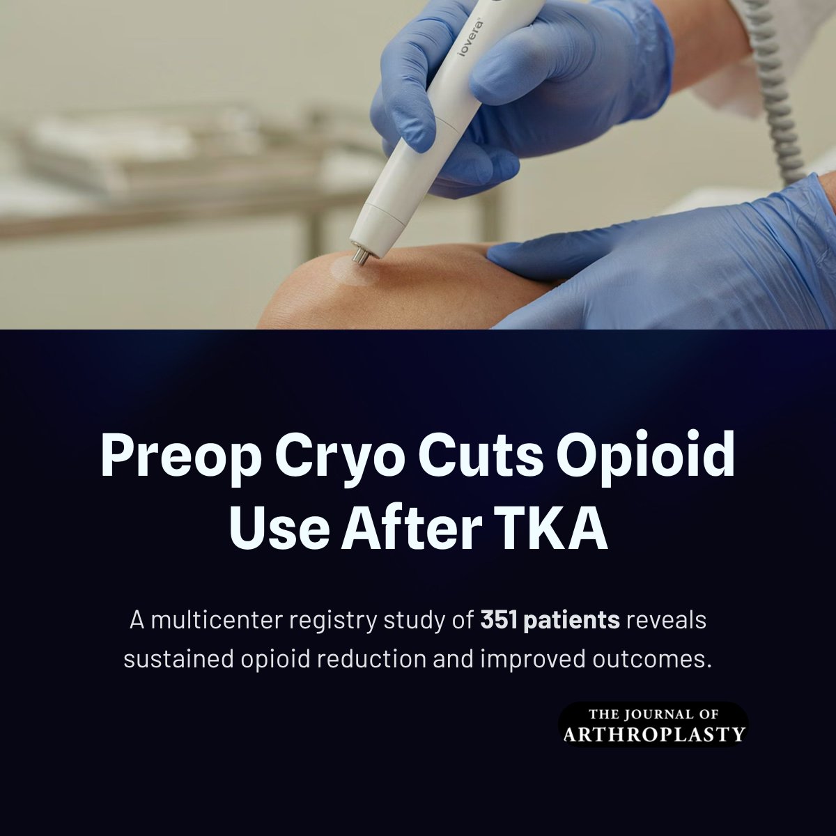 JArthroplasty's tweet photo. Preoperative cryoneurolysis was associated with reduced opioid utilization and lower pain scores following TKA. Our findings support cryoneurolysis as an opioid-sparing adjunct within multimodal perioperative pathways.

https://t.co/xWdrB14ISs https://t.co/pVEvxHPKWu