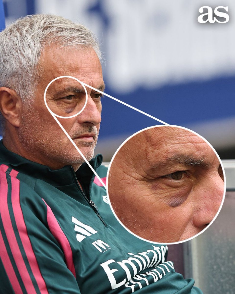 theMadridZone's tweet photo. 🚨 Someone shot the ball on Jose Mourinho’s face in training. @diarioas https://t.co/zIMtCY5DZS