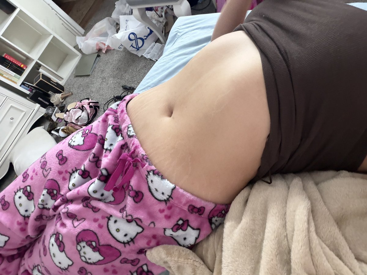 evieluvv_zz's tweet photo. why does my ribcage stick out so much omfg #edrtwt #bodycheck #fatmaxxing https://t.co/wV7yhmi4vU