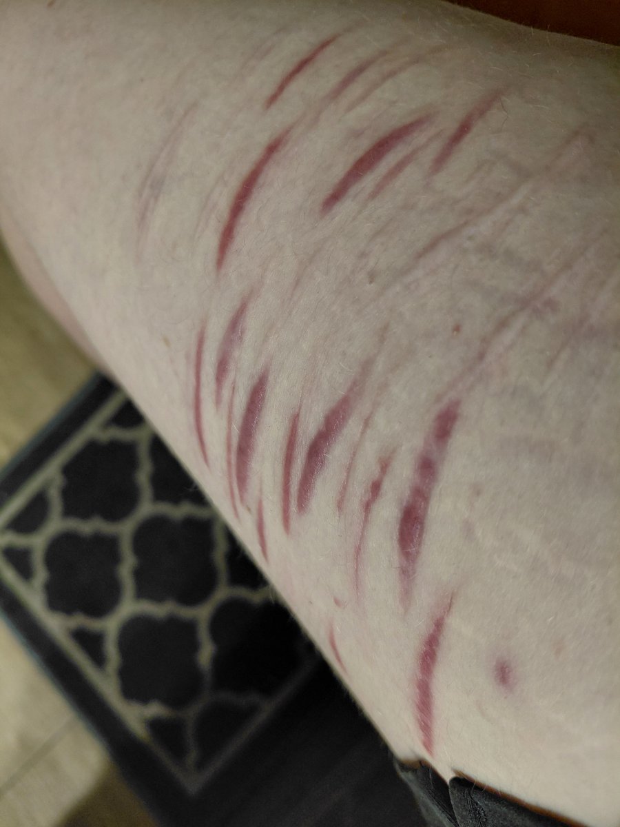 l0ver000's tweet photo. fresh fake sfx makeup vs scars fake sfx makeup, ofc everything is fake!! #shtwt #988twt #sfxmakeup https://t.co/c7uIgA75Hg